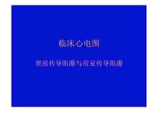 窦房传导阻滞与房室传导阻滞