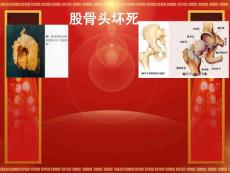 股骨头坏死解剖