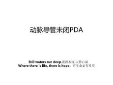 动脉导管未闭PDA