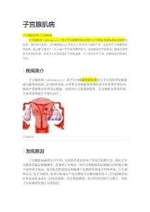 子宫腺肌病