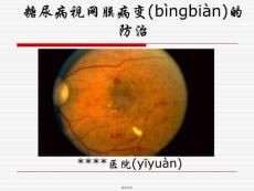 糖尿病视网膜病变宣教