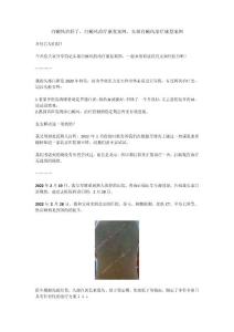 白癜风治好了，白癜风治疗康复案例，头部白癜风治疗康复案例（外部）