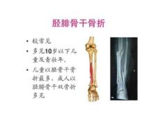 《胫腓骨干骨折》PPT课件
