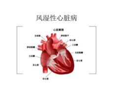 《风湿性心脏病》PPT课件