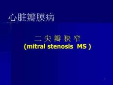 二尖瓣狭窄讲课