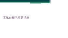 常见白癜风症状详解