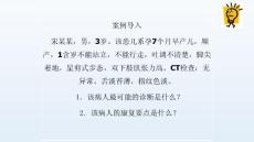 小儿脑性瘫痪