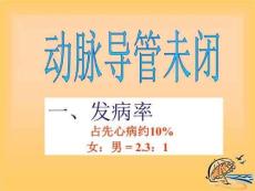 先天性心脏病PDA