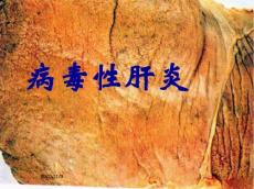 病毒性肝炎肝炎肝硬化