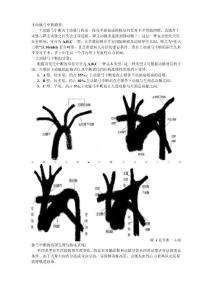 主动脉弓中断