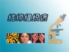 结缔组织病课件PPT