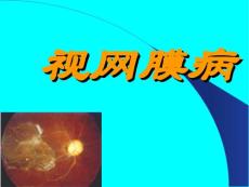 视网膜病(护）