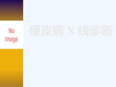 硬皮病X线诊断