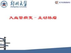 主动脉瘤影像诊断