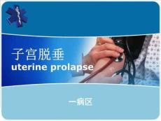 《子宫脱垂》PPT课件