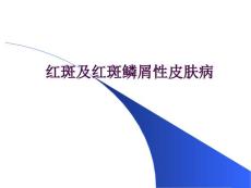 红斑及红斑鳞性皮肤病红斑