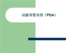动脉导管未闭ppt