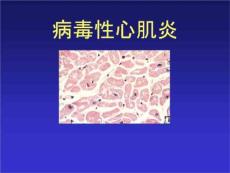 病毒性心肌炎PPT课件