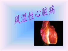 风湿性心脏病ppt