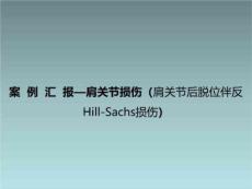 肩关节损伤肩关节后脱位伴反hillsachs损伤文件材料