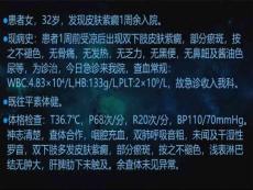 特发性血小板减少性紫癜x