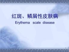 红斑、鳞屑性皮肤病