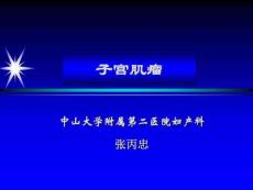 子宫肌瘤