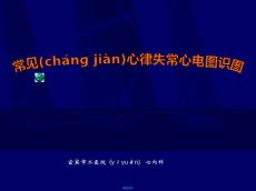 常见心律失常