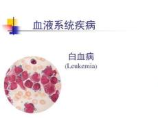 急性白血病课件急性髓系白血病