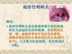 《疱疹性咽峡炎》PPT课件