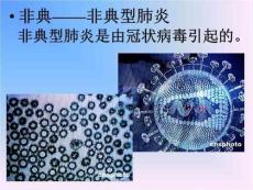 《非典非典型肺炎》PPT课件