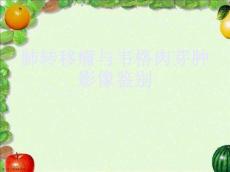 肺转移瘤与韦格肉芽肿影像鉴别