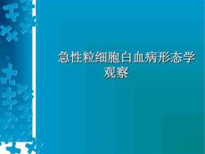 急性粒细胞白血病形态学观察
