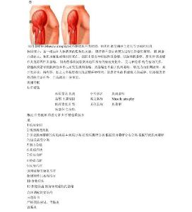 肌肉萎缩症