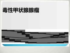 毒性甲状腺腺瘤规范