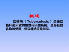 小儿结核病