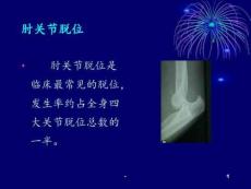 肘关节脱位ppt课件