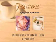 干燥综合征.ppt