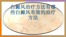 白癜风治疗方法有哪些白癜风有效的治疗方法-PPT课件免费