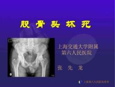 浅谈股骨头坏死