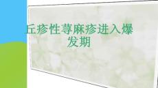 丘疹性荨麻疹进入爆发期-课件(PPT演示)
