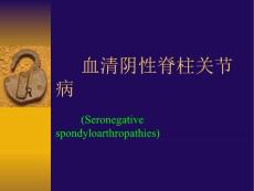 AS血清阴性脊柱关节病课件
