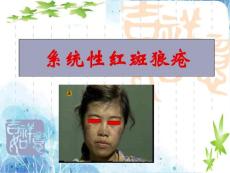 系统性红斑狼疮课件