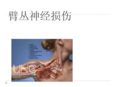 臂丛神经损伤课件