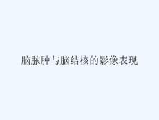 脑脓肿与脑结核的影像表现 ppt