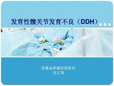 发育性髋关节发育不良