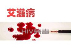 艾滋病预防-预防艾滋病ppt