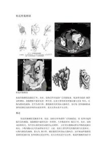 粘连性肠梗阻
