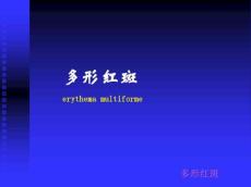 多形红斑课件
