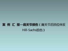 肩关节损伤(肩关节后脱位伴反Hill-Sachs损伤